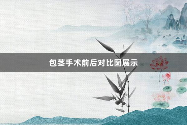 包茎手术前后对比图展示